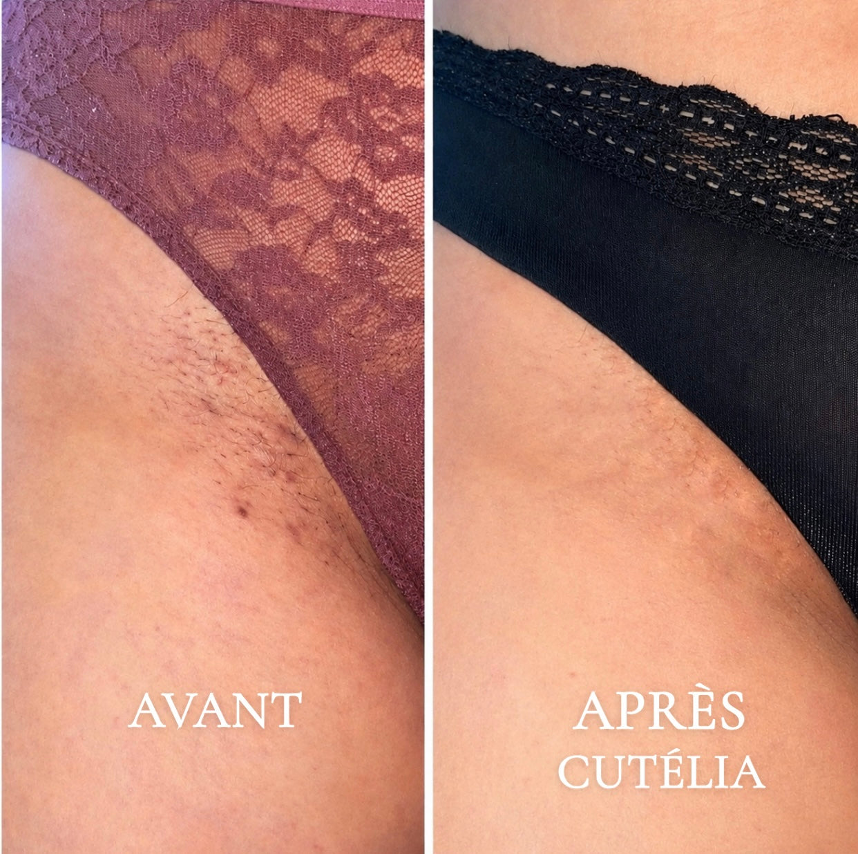 Cutélia Rasoir