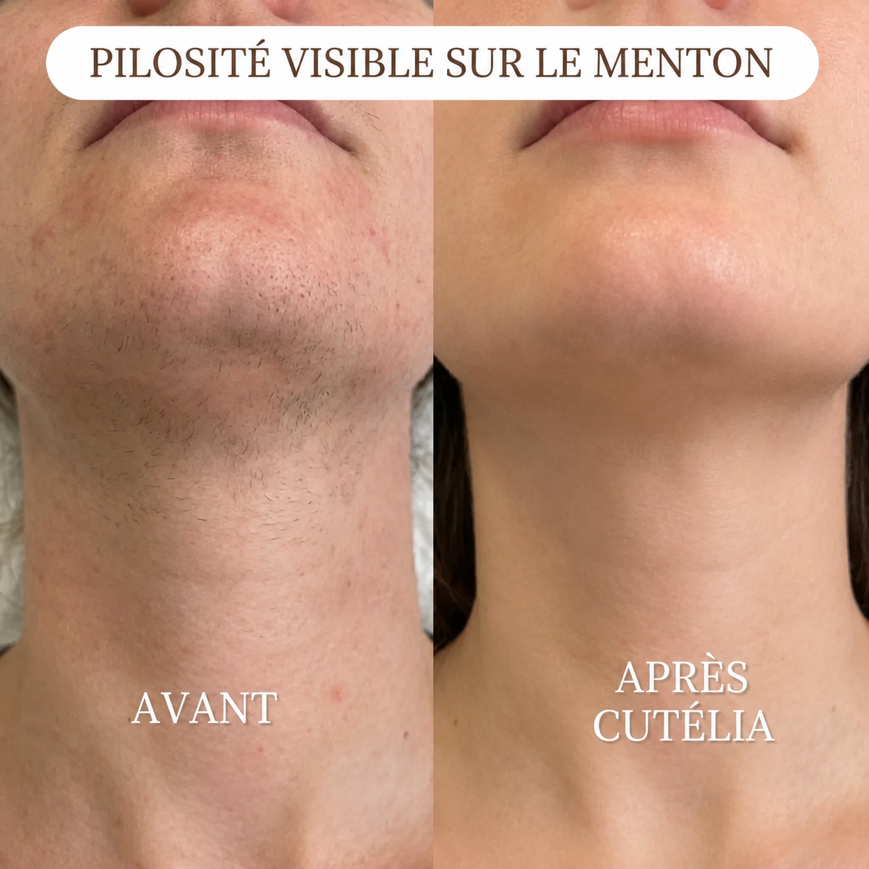 Cutélia Rasoir